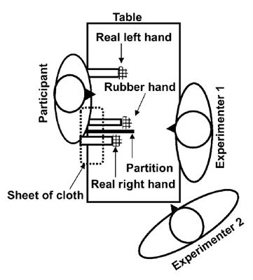 “Fake it till You Make it”! Contaminating Rubber Hands (“Multisensory Stimulation Therapy”) to Treat Obsessive-Compulsive Disorder